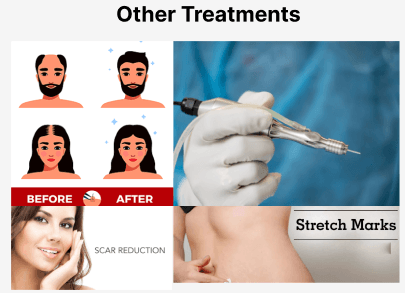 Other Treatments